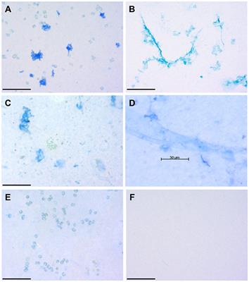 Coomassie Stainable Particles (CSP): Protein Containing Exopolymer Particles in the Ocean